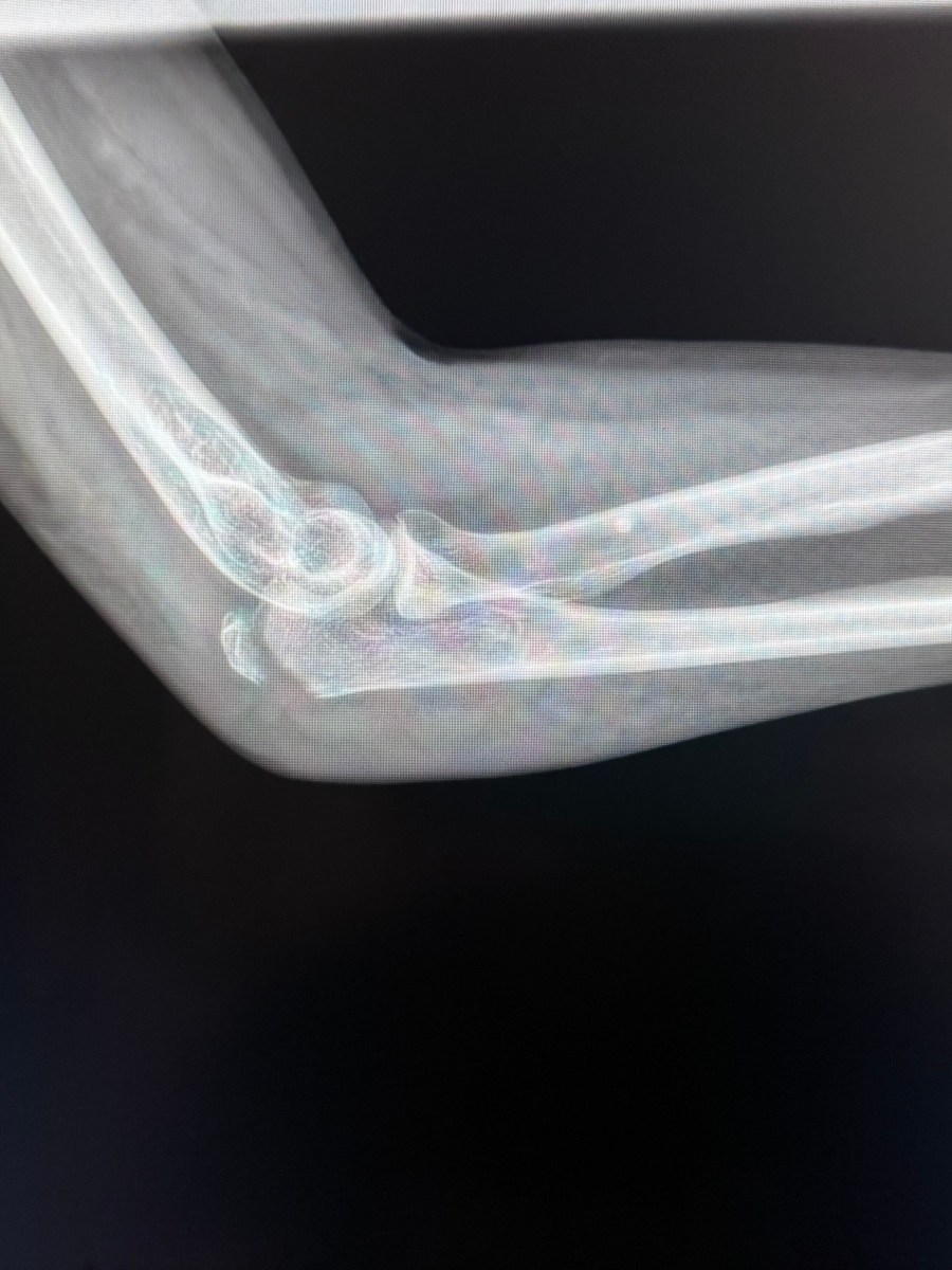 So . . . This&nbsp;Happened